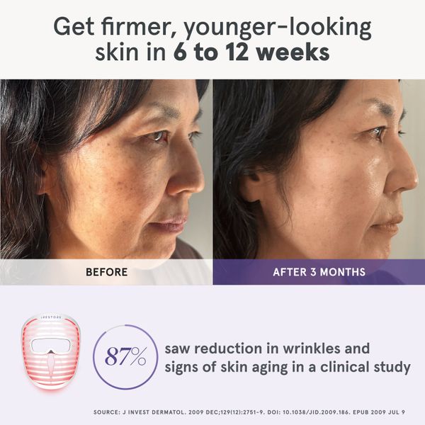 iRESTORE Illumina Face Mask