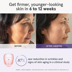 iRESTORE Illumina Face Mask