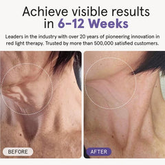 iRESTORE Illumina Neck & Chest Mask
